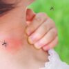 Dengue fever in Thailand, tips to avoid bites